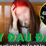 Đau đầu dai dẳng không rõ nguyên nhân, người phụ nữ nhận chẩn đoán ít ai ngờ