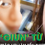 Rộ trào lưu kéo ‘giun’ từ mắt để thải độc gây nguy cơ tổn thương thị lực