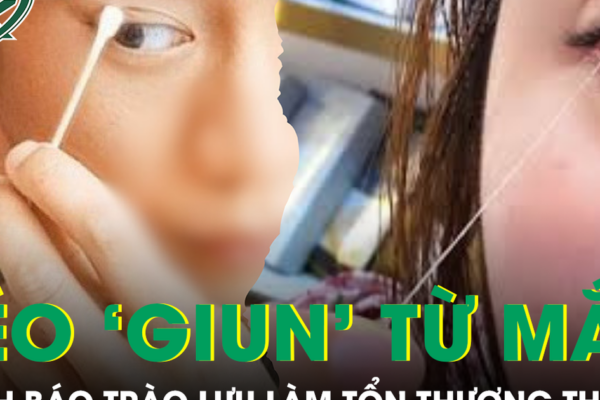 Rộ trào lưu kéo ‘giun’ từ mắt để thải độc gây nguy cơ tổn thương thị lực