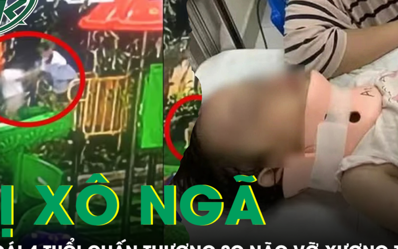 Bé gái 4 tuổi bị bạn xô ngã từ cầu trượt cao 1,5m chấn thương sọ não vỡ xương trán