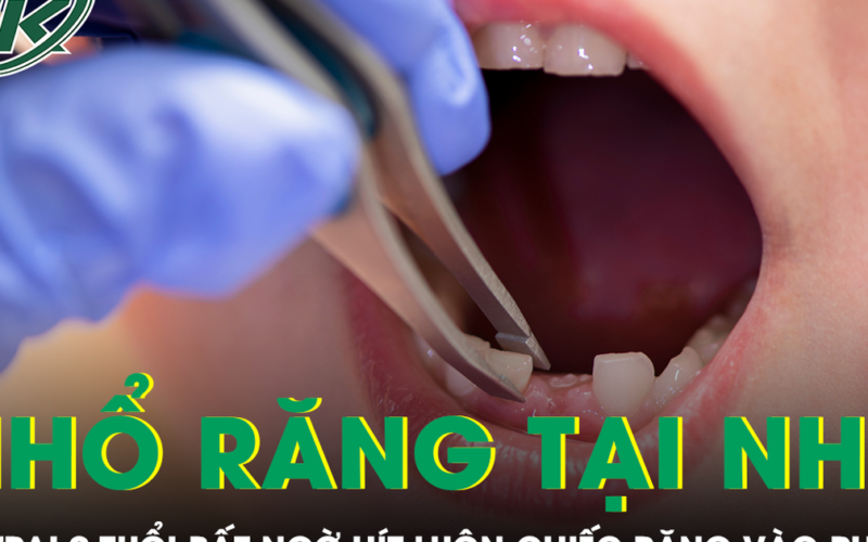 Được mẹ nhổ răng tại nhà, bé trai 9 tuổi bất ngờ hít luôn chiếc răng vào phổi
