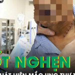 Nuốt nghẹn khi ăn, không ngờ phát hiện mắc ung thư thực quản xâm lấn nguy hiểm