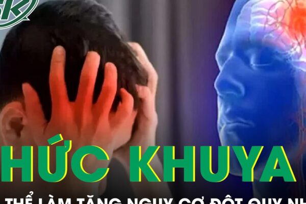 Thức khuya thường xuyên có thể làm tăng nguy cơ đột quỵ nhẹ ở người trẻ
