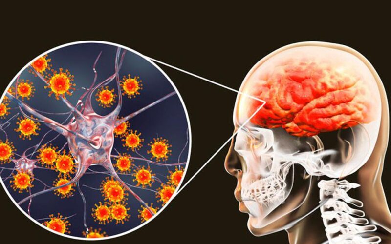 Hà Nội ghi nhận ca viêm não Nhật Bản, bác sĩ khuyến cáo cách phòng bệnh hiệu quả
