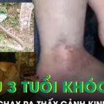 Nghe cháu trai 3 tuổi khóc thét, ông nội chạy ra phát hiện cảnh kinh hoàng bên vườn rau