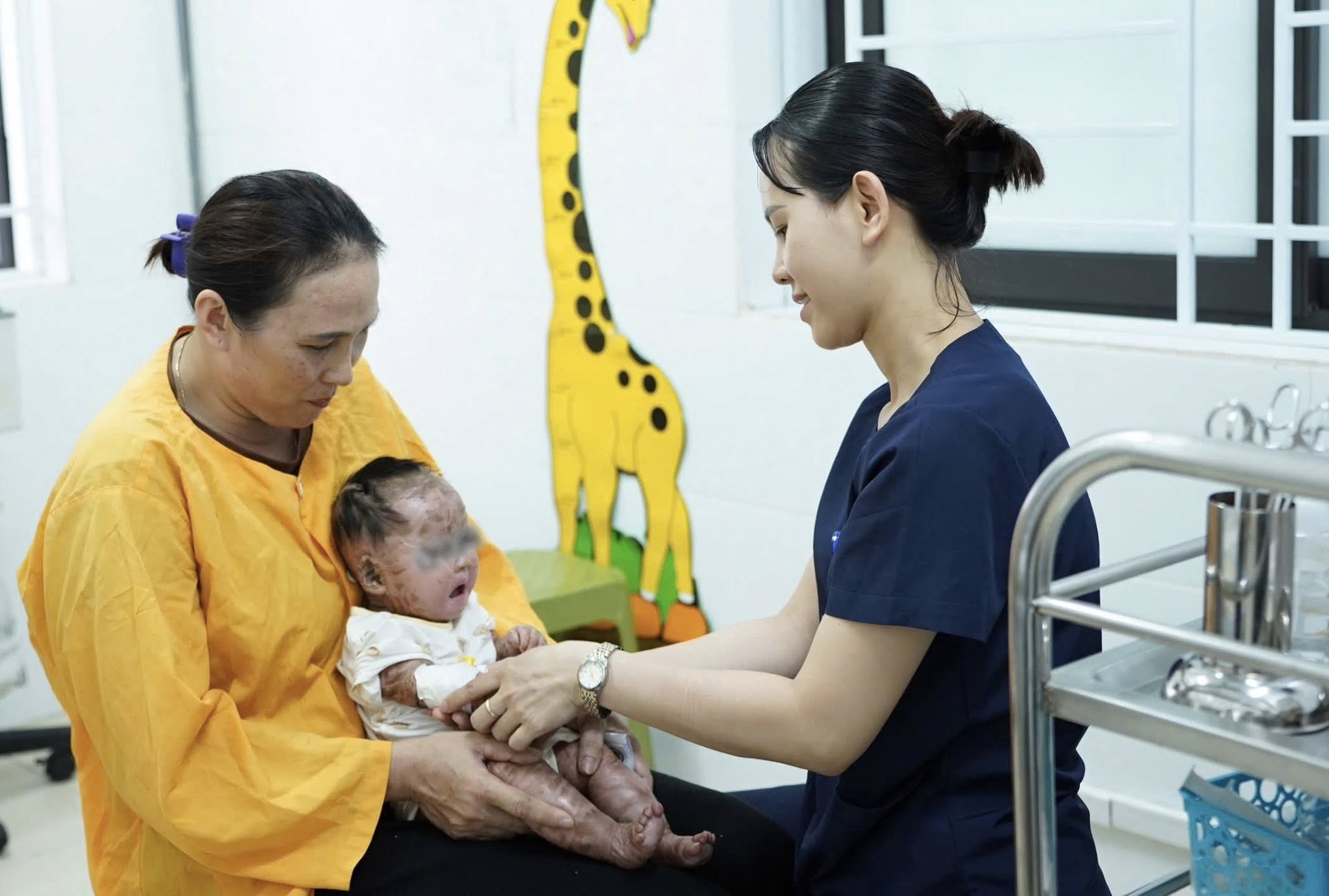 Bé gái 4 tháng tuổi mắc bệnh da hiếm gặp, viêm phổi tái diễn được điều trị ổn định- Ảnh 2.