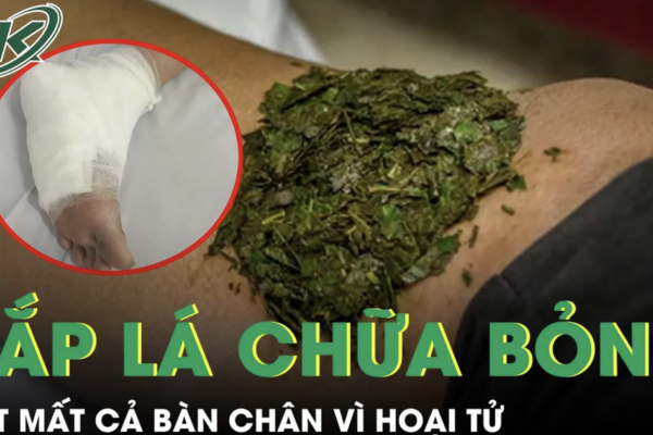 Đắp lá chữa bỏng, người đàn ông tiểu đường suýt mất cả bàn chân