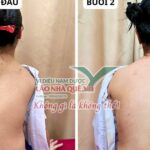 Tìm hiểu nguyên lý ‘Khai thông cột sống’ của Lão Nhà Quê