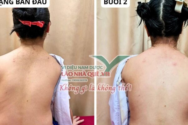 Tìm hiểu nguyên lý ‘Khai thông cột sống’ của Lão Nhà Quê