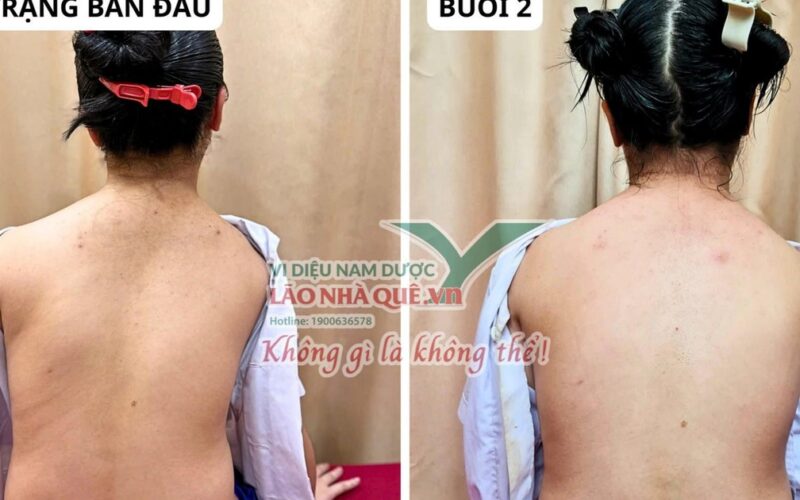 Tìm hiểu nguyên lý ‘Khai thông cột sống’ của Lão Nhà Quê