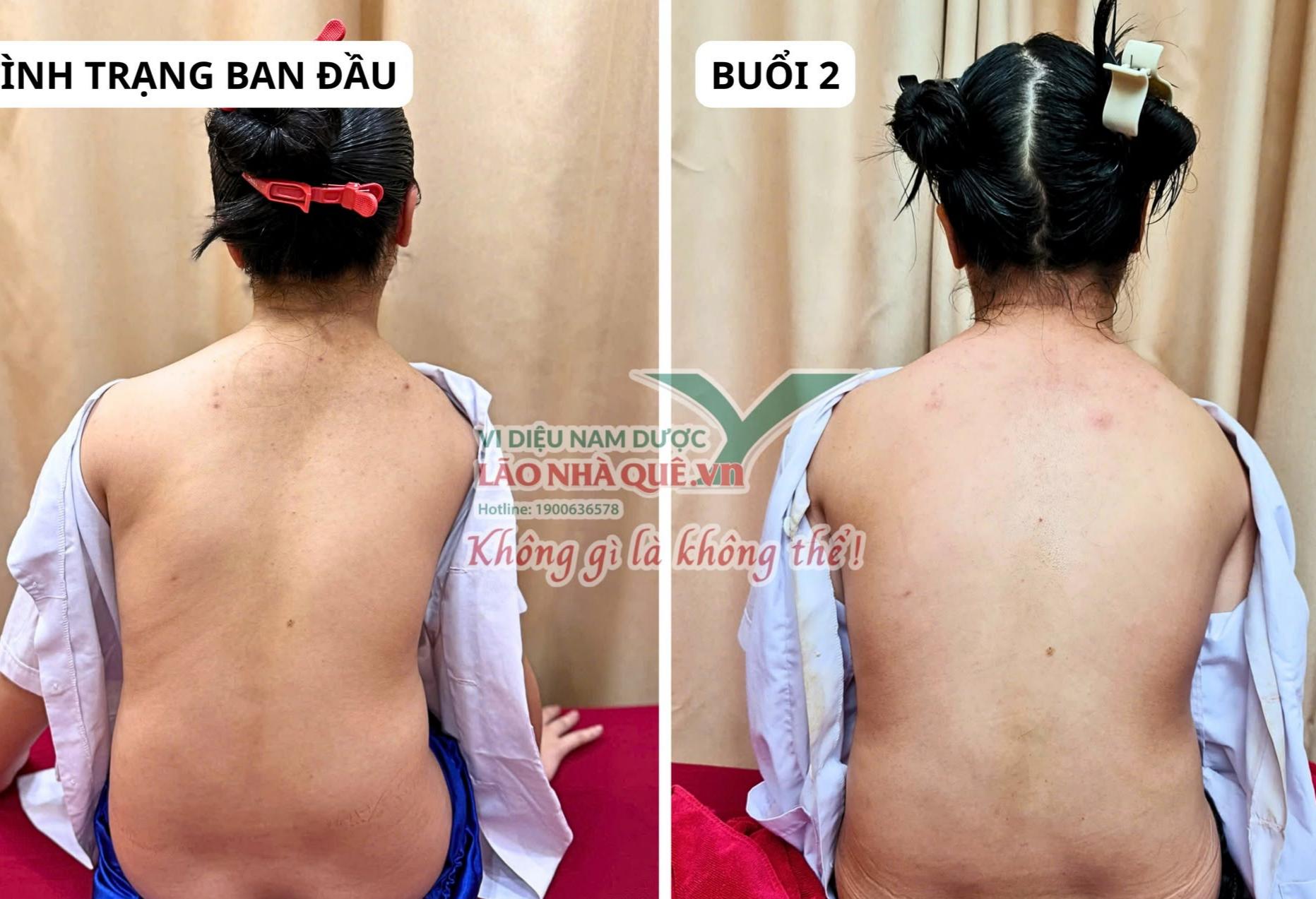 Tìm hiểu nguyên lý 'Khai thông cột sống' của Lão Nhà Quê- Ảnh 2.