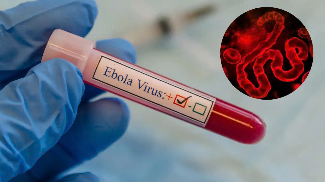 ebola-anh-minh-hoa-17791576352571070848441 WHO cảnh báo khẩn về Ebola, Bộ Y tế yêu cầu tăng cường giám sát, ngăn dịch xâm nhập- Ảnh 1.