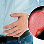 Nguyên nhân thường gặp khiến gan nhiễm mỡ ngày càng “trẻ hóa”