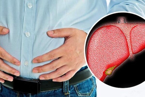 Nguyên nhân thường gặp khiến gan nhiễm mỡ ngày càng “trẻ hóa”