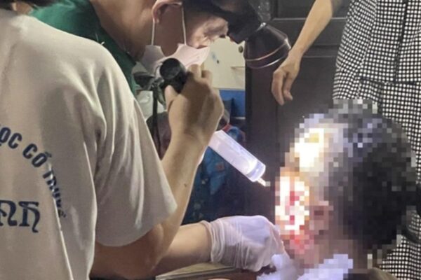 Sở Y tế Hà Nội nói gì về vụ mổ khối u tại cơ sở chữa bệnh bằng nước?