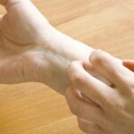 Cải thiện tình trạng ngứa ở người bệnh tiểu đường