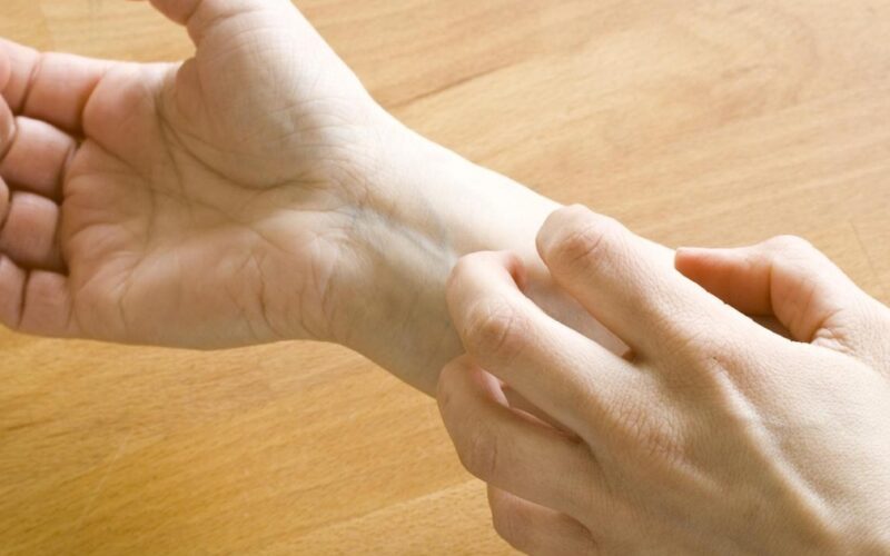 Cải thiện tình trạng ngứa ở người bệnh tiểu đường