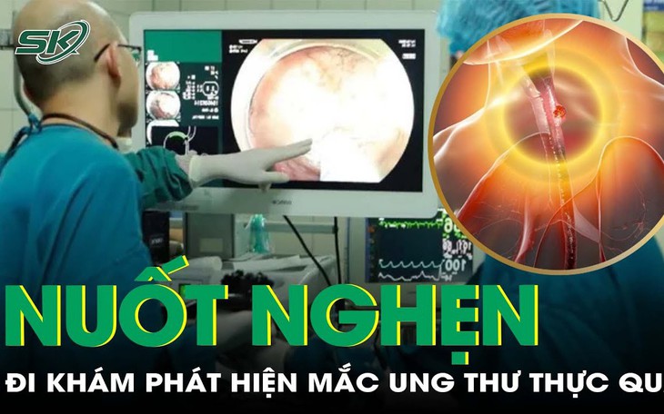 Khó nuốt kéo dài sau tết, người đàn ông phát hiện ung thư thực quản