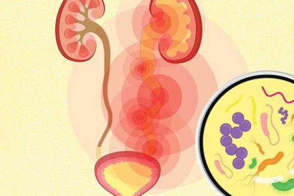 Nhiễm khuẩn tiết niệu có biểu hiện như thế nào?