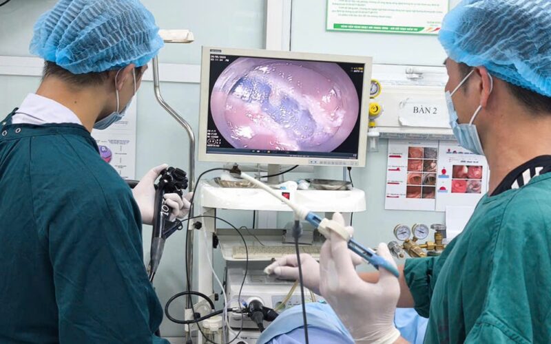 Cứ nghĩ bị trĩ, người phụ nữ bất ngờ phát hiện khối polyp lớn trong trực tràng