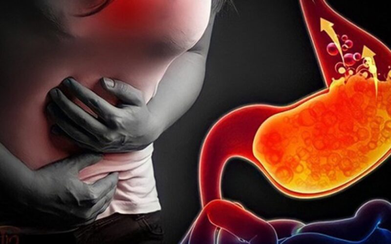 Huyệt vị hỗ trợ chứng trào ngược dạ dày