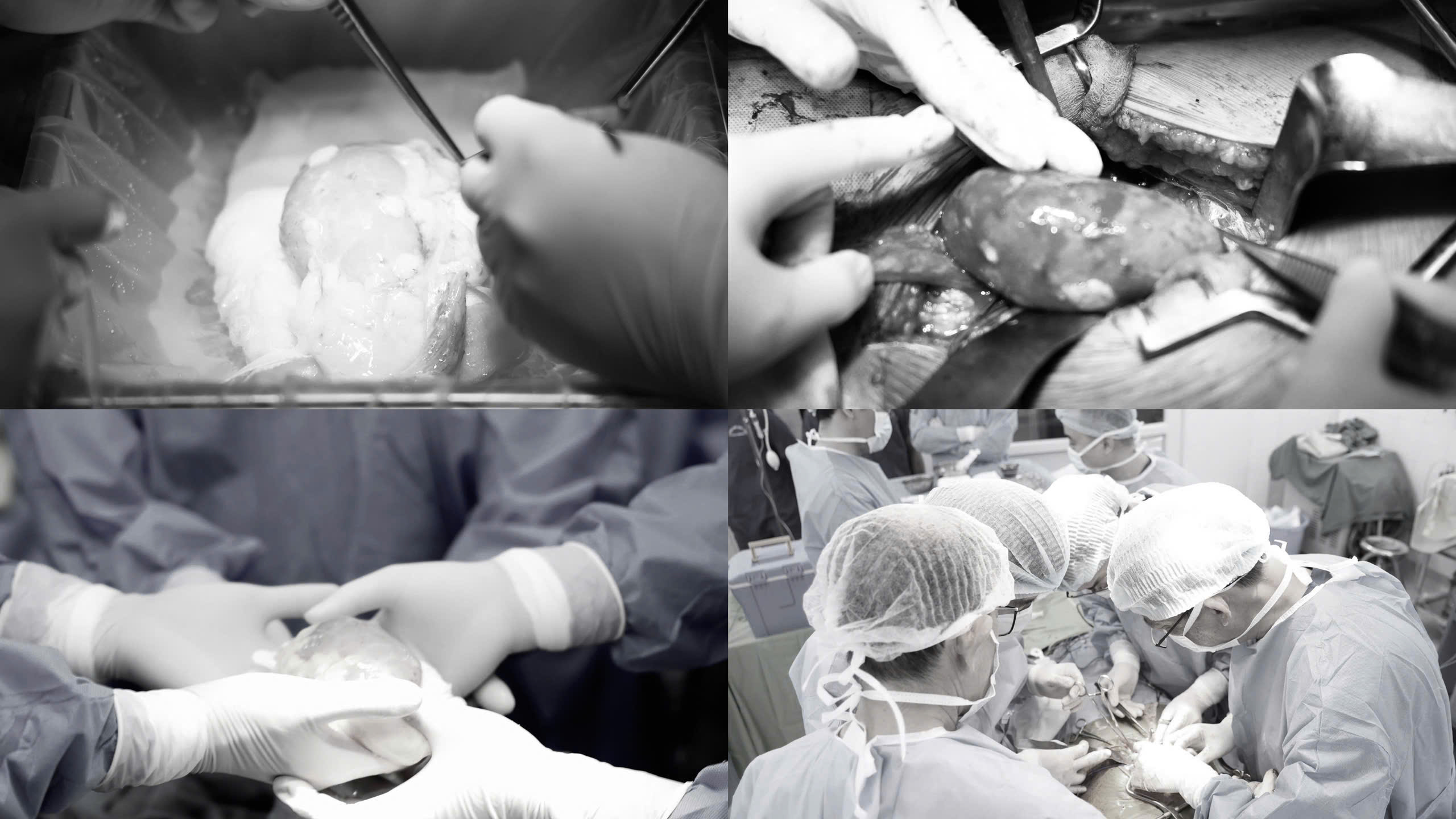 Bệnh viện Hữu nghị Việt Tiệp thực hiện ca ghép thận đầu tiên từ người hiến chết não- Ảnh 2.
