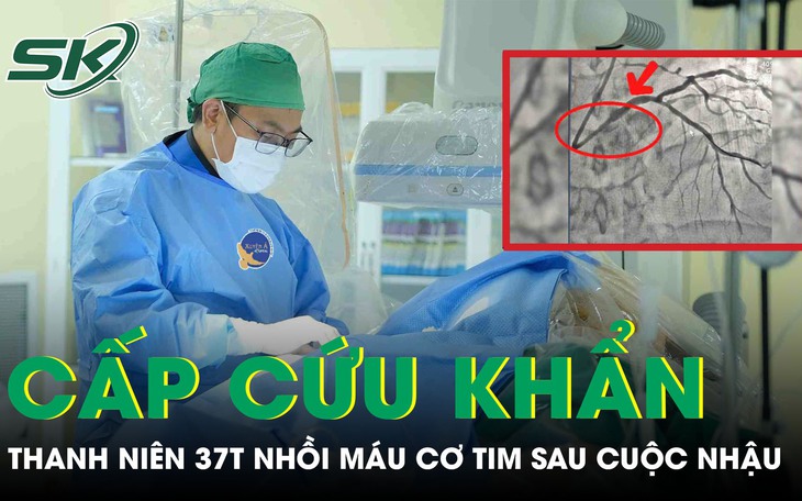 Sau cuộc nhậu, người đàn 37 tuổi bất ngờ lên cơn nhồi máu cơ tim phải cấp cứu khẩn