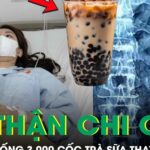 Uống 3.000 cốc trà sữa thay nước lọc suốt 9 năm, thận cô gái mọc chi chít sỏi