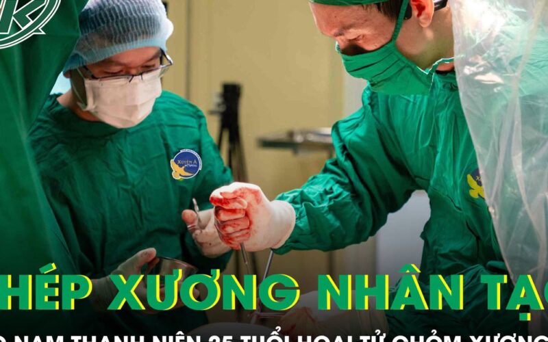 Ghép xương nhân tạo cho nam thanh niên 25 tuổi bị hoại tử chỏm xương đùi