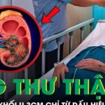 Người đàn ông 45 tuổi tá hỏa phát hiện mắc ung thư thận từ dấu hiệu đau lưng