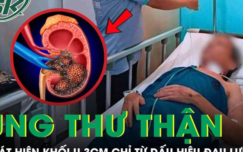 Người đàn ông 45 tuổi tá hỏa phát hiện mắc ung thư thận từ dấu hiệu đau lưng