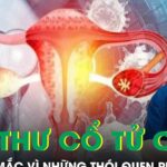 Phụ nữ dễ mắc ung thư cổ tử cung vì những thói quen phổ biến này