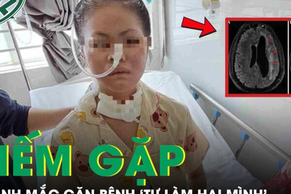 Nữ sinh 19 tuổi mắc căn bệnh ‘tự làm hại mình’ hiếm gặp