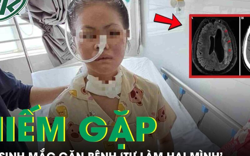 Nữ sinh 19 tuổi mắc căn bệnh ‘tự làm hại mình’ hiếm gặp