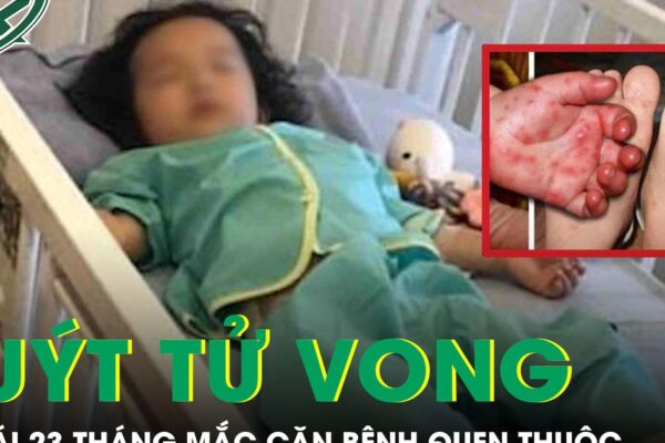 Bé gái 23 tháng tuổi suýt tử vong vì căn bệnh quen thuộc
