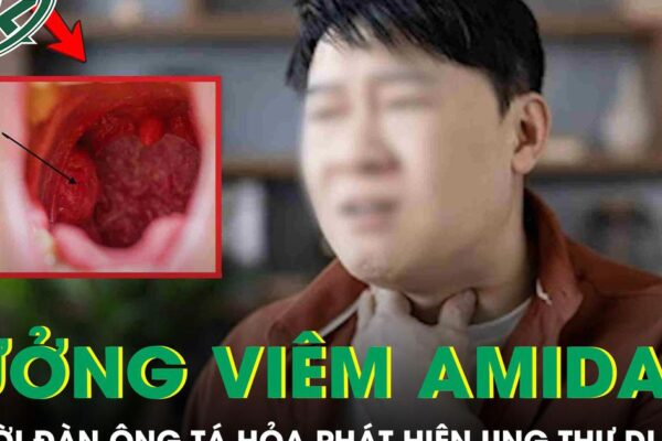 Tưởng viêm amidan, người đàn ông 60 tuổi ‘chết lặng’ phát hiện ung thư di căn