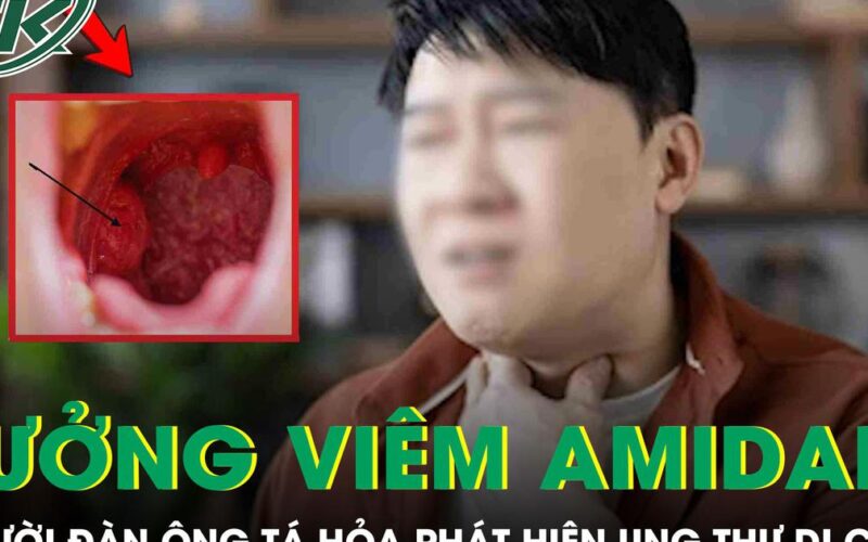 Tưởng viêm amidan, người đàn ông 60 tuổi ‘chết lặng’ phát hiện ung thư di căn
