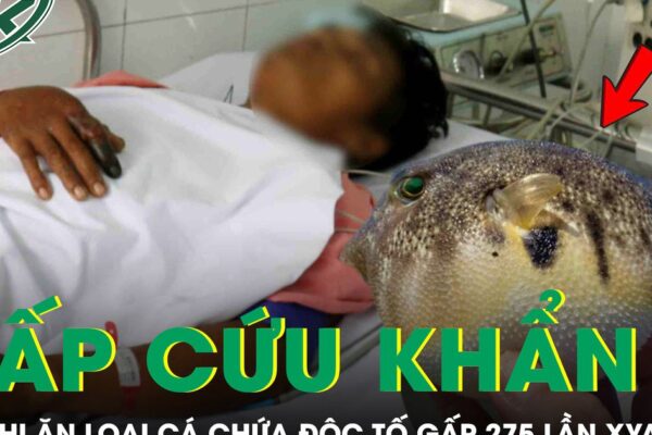 Người đàn ông 33 tuổi phải cấp cứu sau khi ăn loại cá chứa độc tố đáng sợ gấp 275 lần xyanua