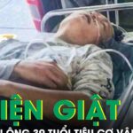 Người đàn ông 39 tuổi tiêu cơ vân cấp sau bị điện giật