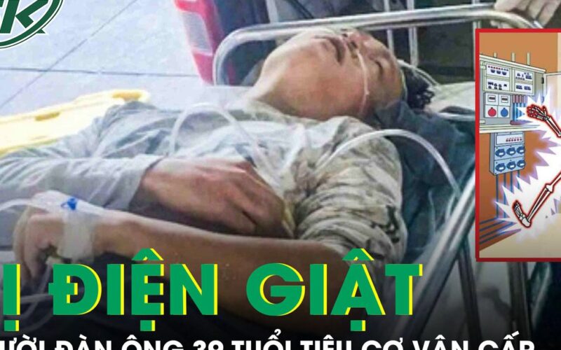 Người đàn ông 39 tuổi tiêu cơ vân cấp sau bị điện giật