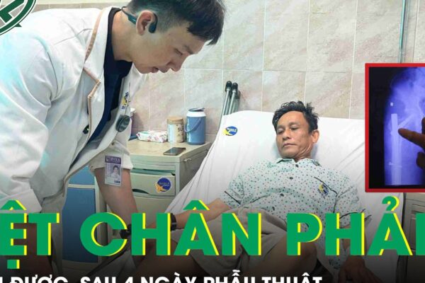 Ngã từ trên xe tải, bệnh nhân may mắn thoát nguy cơ liệt chân nhờ kỹ thuật đóng đinh chống xoay PFNA