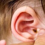 Dấu hiệu nhọt ống tai ngoài ở trẻ và cách xử trí đúng