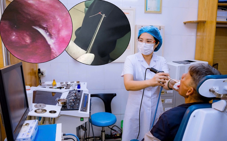 Đi nắng về rồi nhai đá lạnh, cụ ông rơi vào nguy kịch- Ảnh 1.