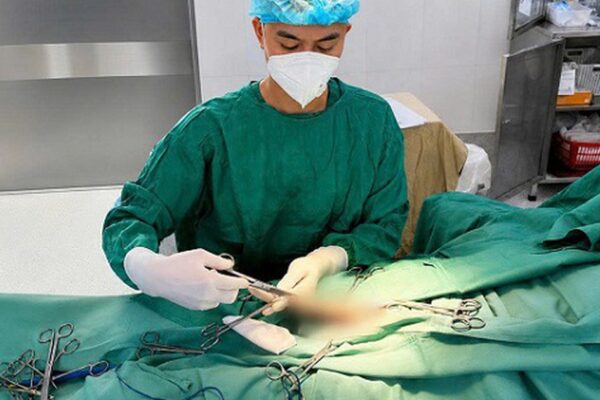 Cụ ông 74 tuổi mệt mỏi khi có ‘rổ sỏi’ lạo xạo trong bao quy đầu