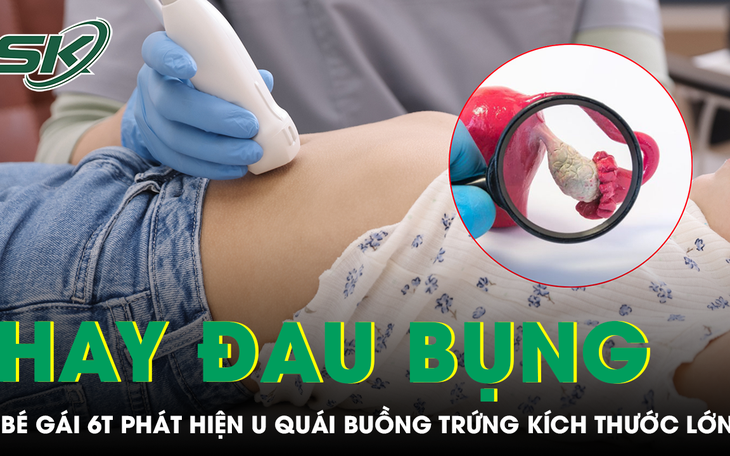 Bé sơ sinh 2 ngày tuổi mang khối u quái nặng 1,1kg- Ảnh 3.