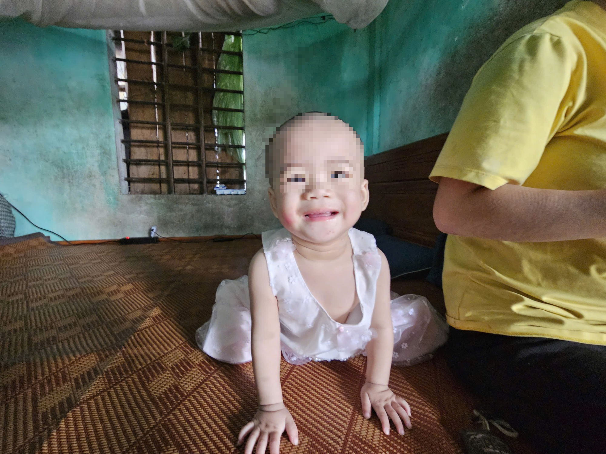 Tình trạng của cháu bé bị mẹ và cậu tâm thần gây hại- Ảnh 2.